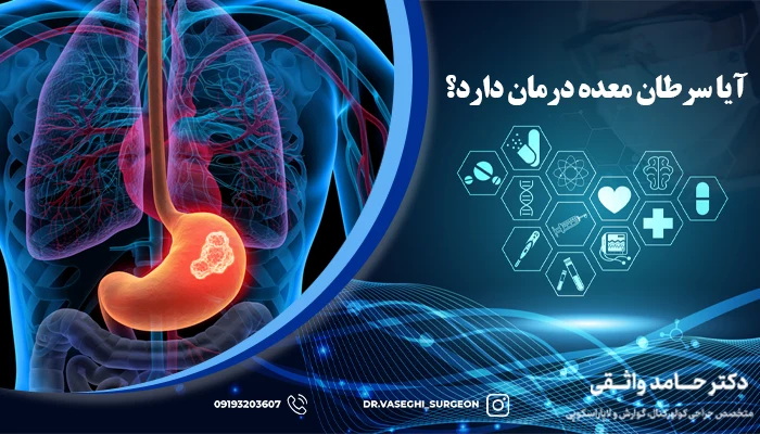 علل ابتلا به سرطان معده و همه چیز در مورد gastric cancer