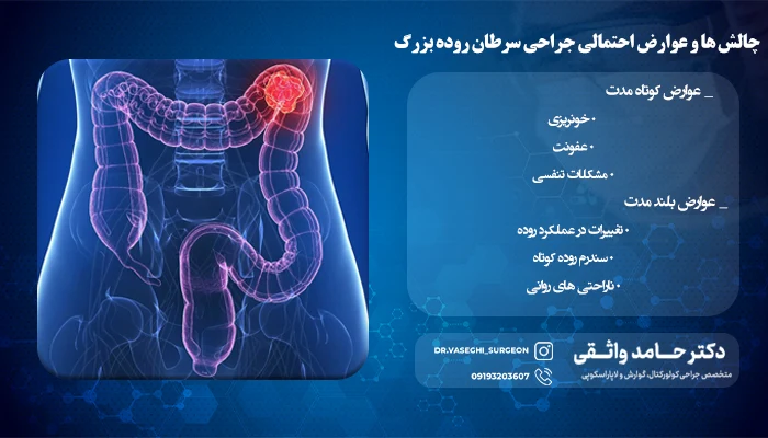 چالش های بعد از عمل جراحی روده