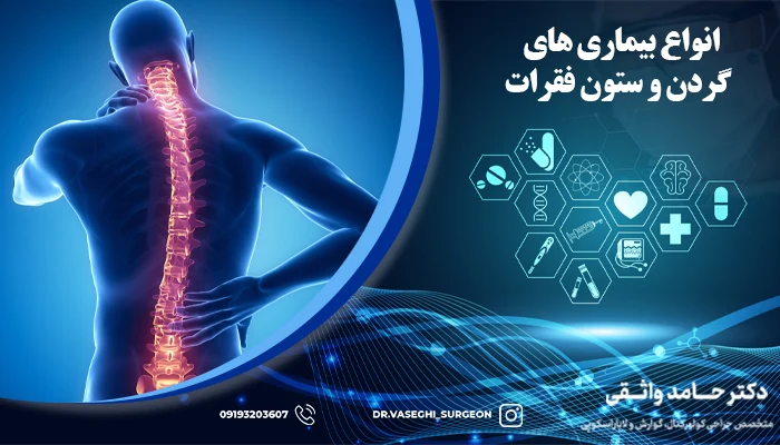 عکسی از بیماری گردن و ستون فقرات