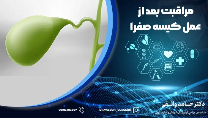 کیسه صفرا بزرگ شده