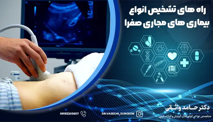 سونوگرافی بافت و سطحی، یکی از روش های تشخیص بیماری های صفراوی است.