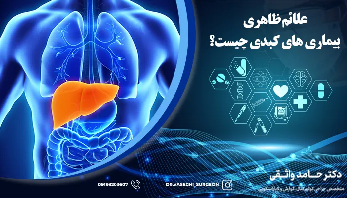 علائم ظاهری بیماری های کبد