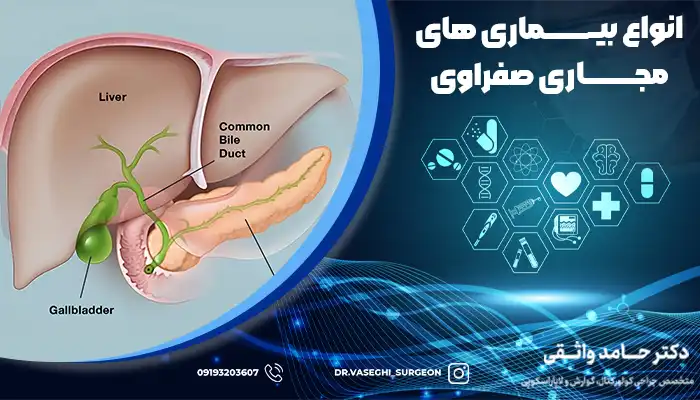 بیماری های صفراوی
