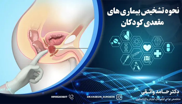 تشخیص بیماری های مقعدی کودکان