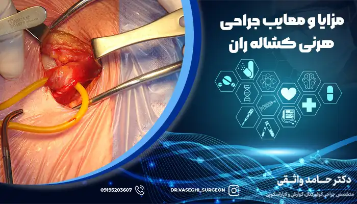 جراحی هرنی کشاله ران