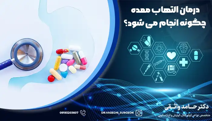 استفاده از داروهای ضد التهاب و کنترل اسید معده، روش های درمان التهاب معده است.