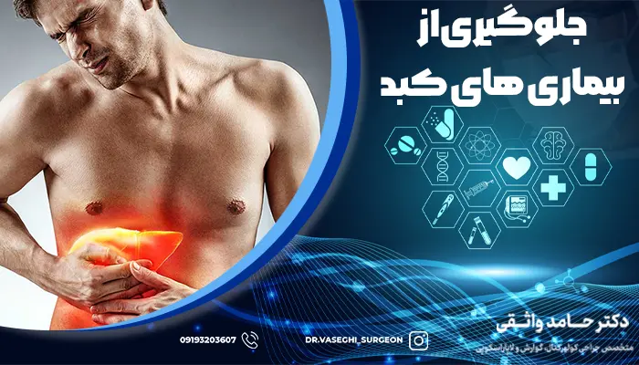 جلوگیری از بیماری های کبدی