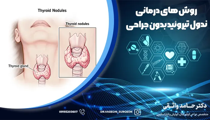 روش های درمانی ندول تیروئید بدون جراحی