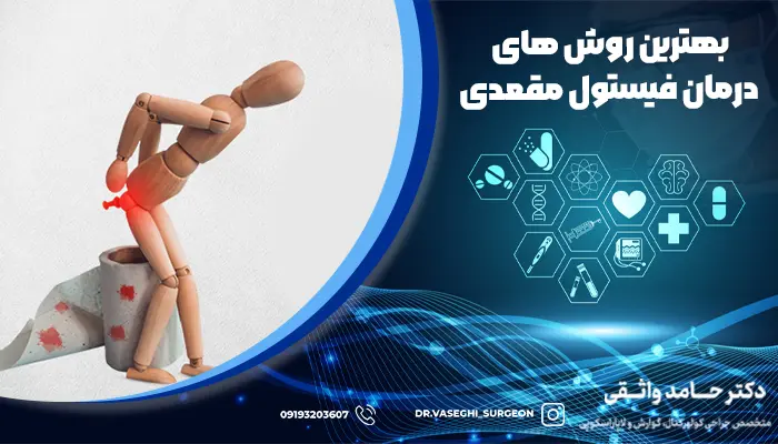 روش های درمان فیستول