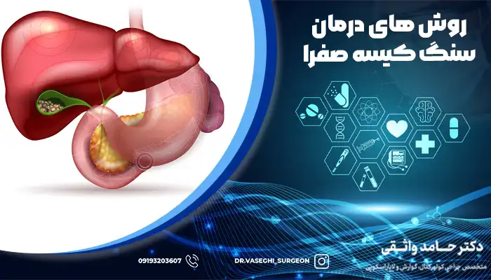 کیسه صفرا ملتهب و نیازمند به درمان