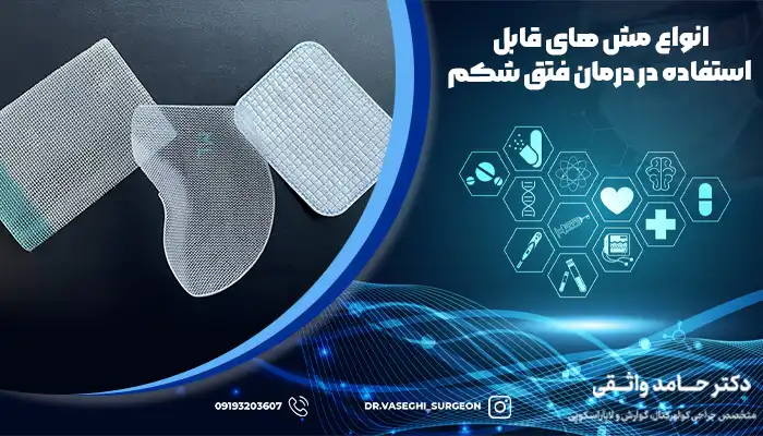 مش های قابل استفاده برای جراحی فتق شکمی