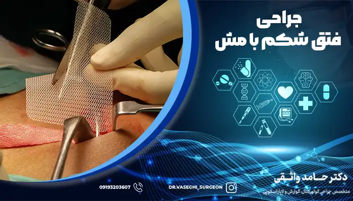 جراحی فتق شکمی با استفاده از مش برای کنترل علامت های فتق